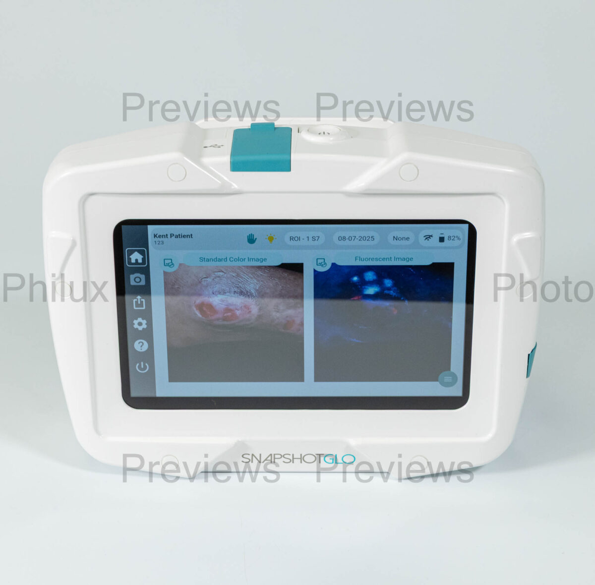 PhPh-250807-115459-c09-1613_prev